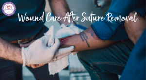 wound care after suture removal